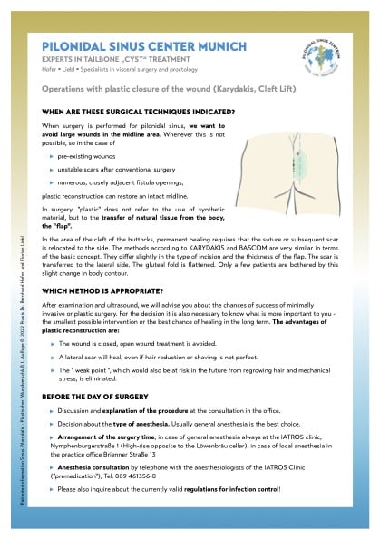 Info flyer about Karydakis surgery for sinus pilonidalis